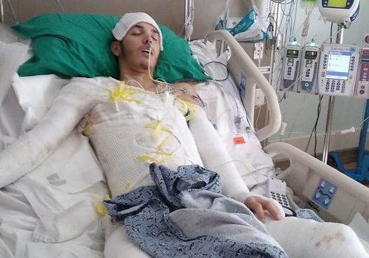 Jean Barreto was severely injured in the Feb. 27 incident.