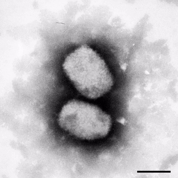 El virus de la viruela del mono.
