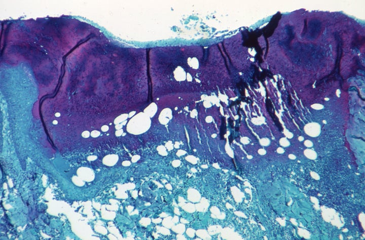 Vista microscópica de una muestra del virus de la viruela del mono, en una imagen de archivo.