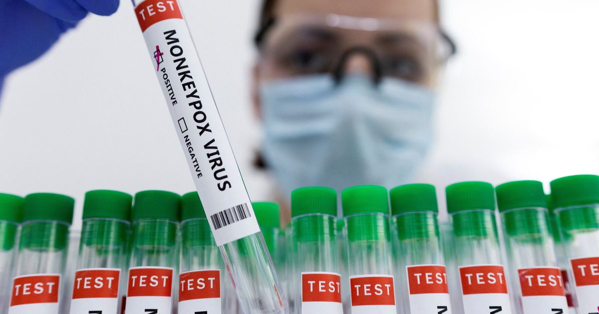 Trois cas de variole du singe désormais recensés en France, l'OMS rassure