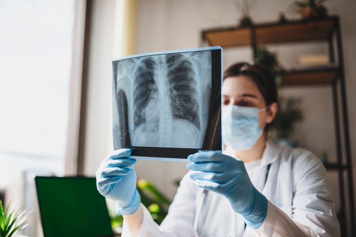 Female Doctor Observing X-Ray Of The Chest