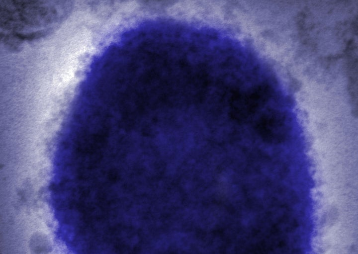 Monkeypox virus