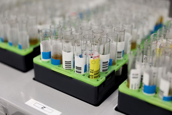 PCR test specimens are seen at a microbiology laboratory in Madrid, Spain. The hospital has begun PCR testing for monkeypox.