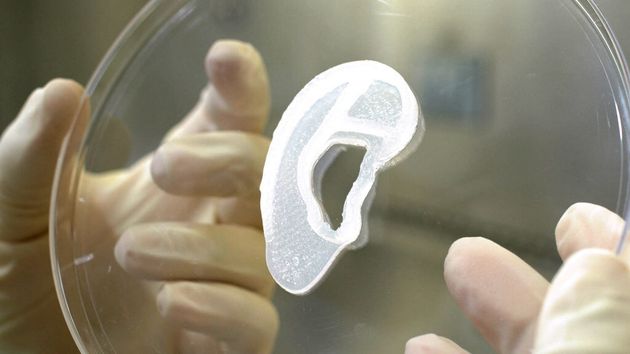Un bioimplant d'une oreille externe imprimé en 3D - 3D Bio Therapeutics