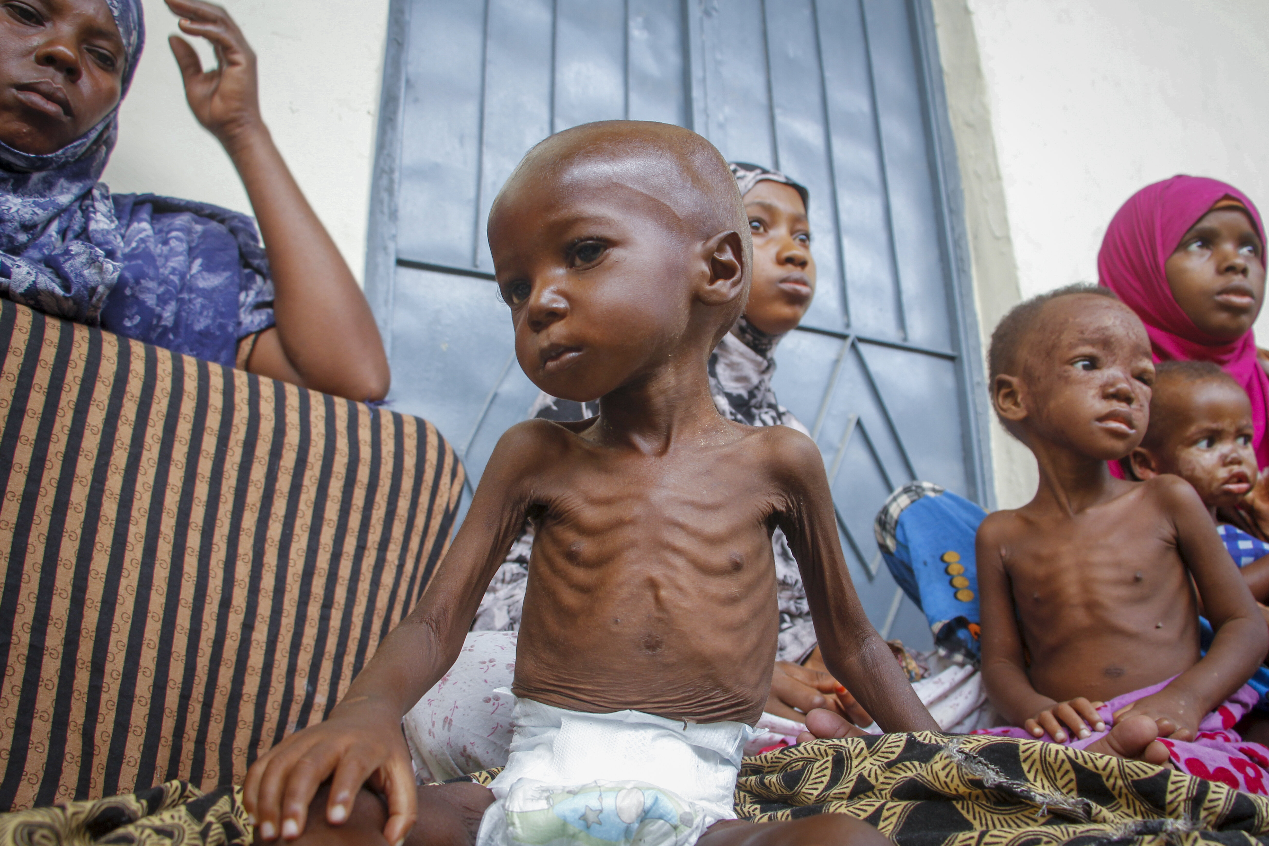 'Explosion Of Child Deaths' Coming To Horn Of Africa, UNICEF Says ...