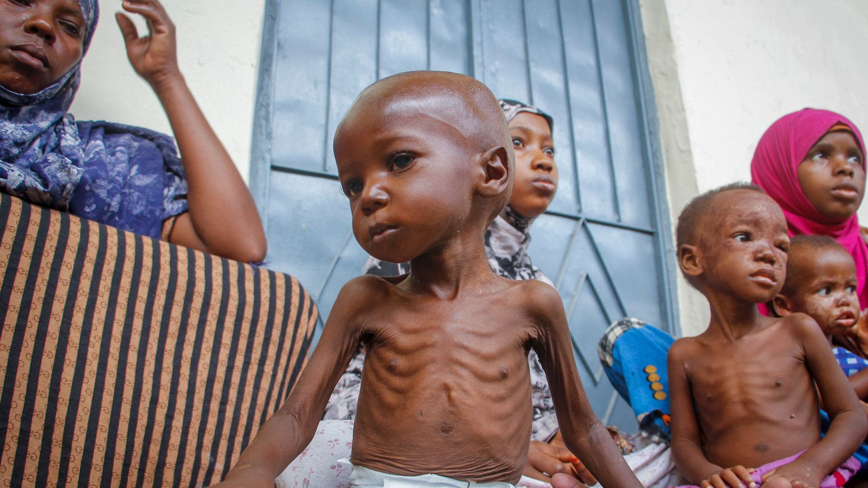 « L’explosion des décès d’enfants » arrive dans la Corne de l’Afrique, selon l’UNICEF