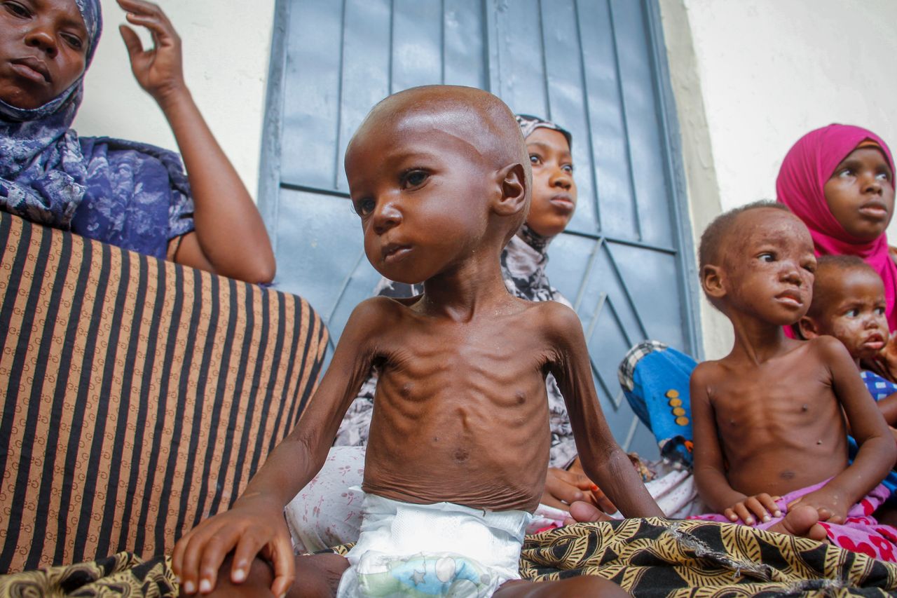 A malnourished 2 year-old sits by his mother, left, who was recently displaced by drought, at a malnutrition stabilization center in Mogadishu, Somalia.