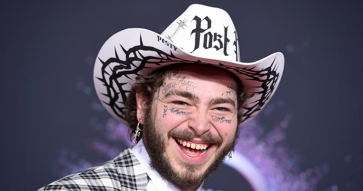 what's on post malone's teeth - Ilustrasi 2