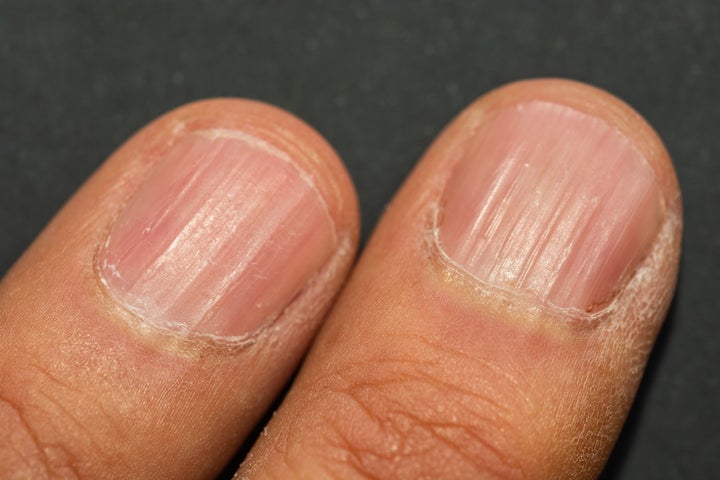 Your Fingernails Are Showing Your Age. Here's What To Do About It