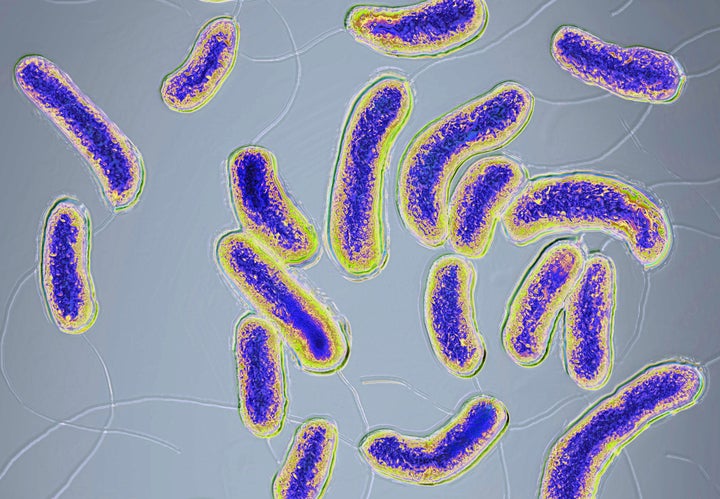 Muestra de la bacteria 'vibrio cholerae'.