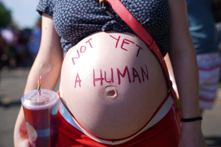 An abortion rights activist stands outside the Supreme Court in Washington.