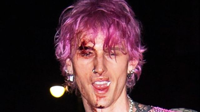 Machine Gun Kelly Smashes Glass On Face, Gives Bloody Performance At Afterparty.jpg
