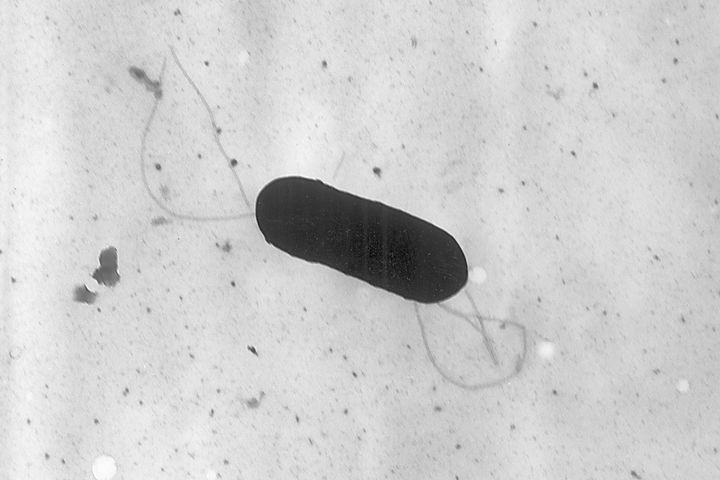 This 2002 electron microscope image made available by the Centers for Disease Control and Prevention shows a Listeria monocytogenes bacterium. 