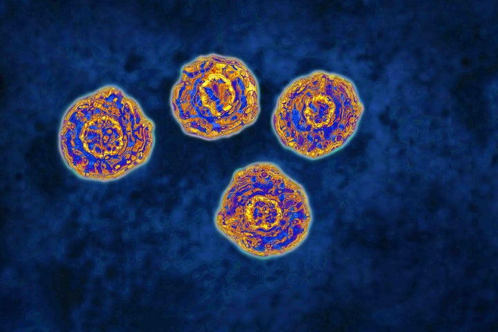 Hepatitis, virus.