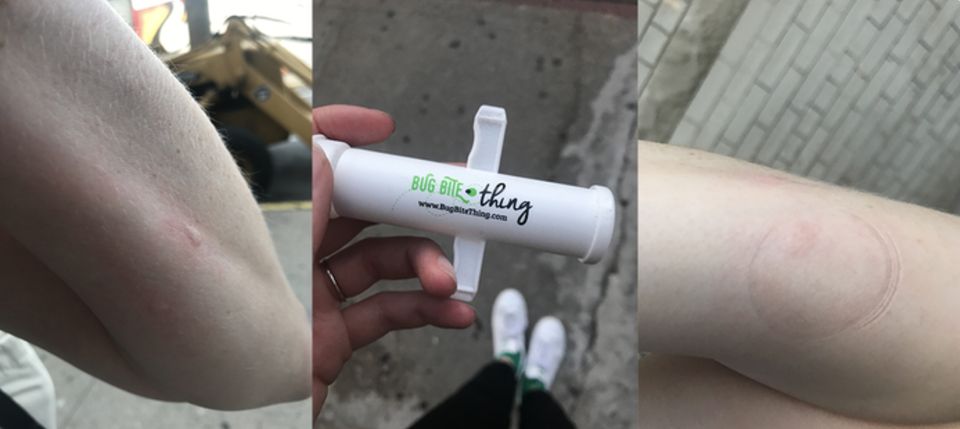 A delightful little tool called the "Bug Bite Thing" that suctions on all kinds of bug bites to reduce swelling, itchiness, and redness