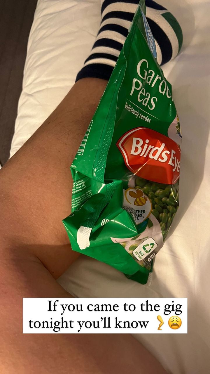 Alan sparked concern after posting a picture icing his leg after the show