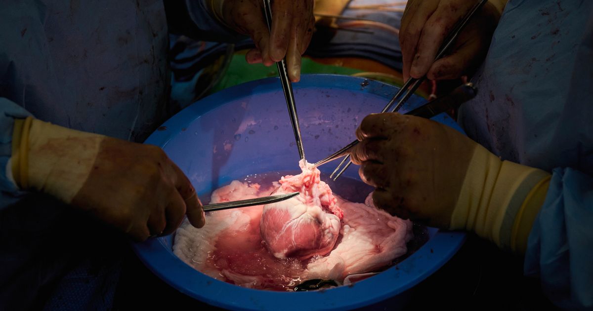 Pig Organ Transplants Inch Closer With Testing In The Dead