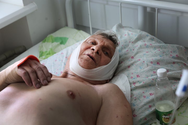 A man recovers in the hospital after being wounded in a cluster bomb attack on June 30, 2022 in Sloviansk, Ukraine.