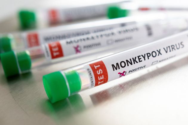 Face à la variole du singe, l'OMS déclenche le niveau d'alerte maximal