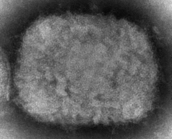 This 2003 electron microscope image made available by the U.S. Centers for Disease Control and Prevention shows mature, oval-shaped monkeypox virions, left, and spherical immature virions, right, obtained from a sample of human skin associated with the 2003 prairie dog outbreak.