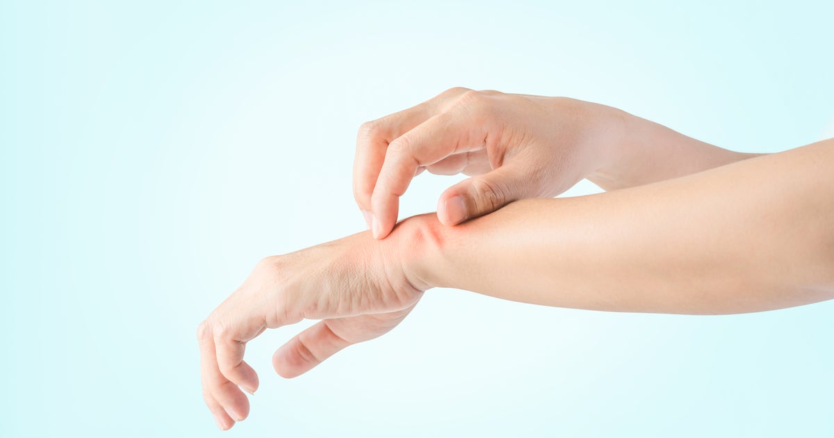 Why Your Post-Covid Skin Rash Is Not Necessarily Long Covid | HuffPost ...