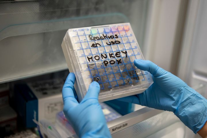 Una investigadora maneja varias muestras de la viruela del mono