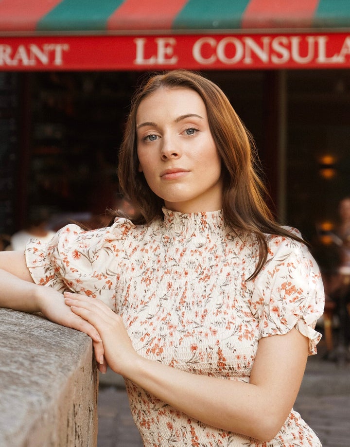 At 21, Dana, an Australian travel blogger, got lip fillers like Kylie Jenner did.