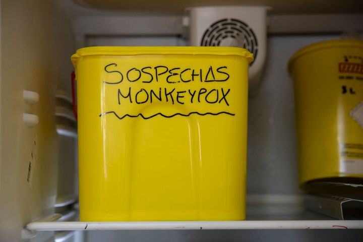 Caja con muestras sospechosas de viruela del mono.