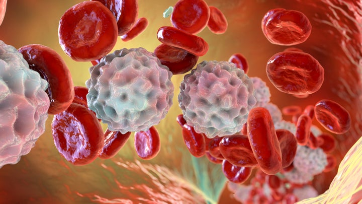 Illustration of lymphocytosis, showing abundant white blood cells inside blood vessel.