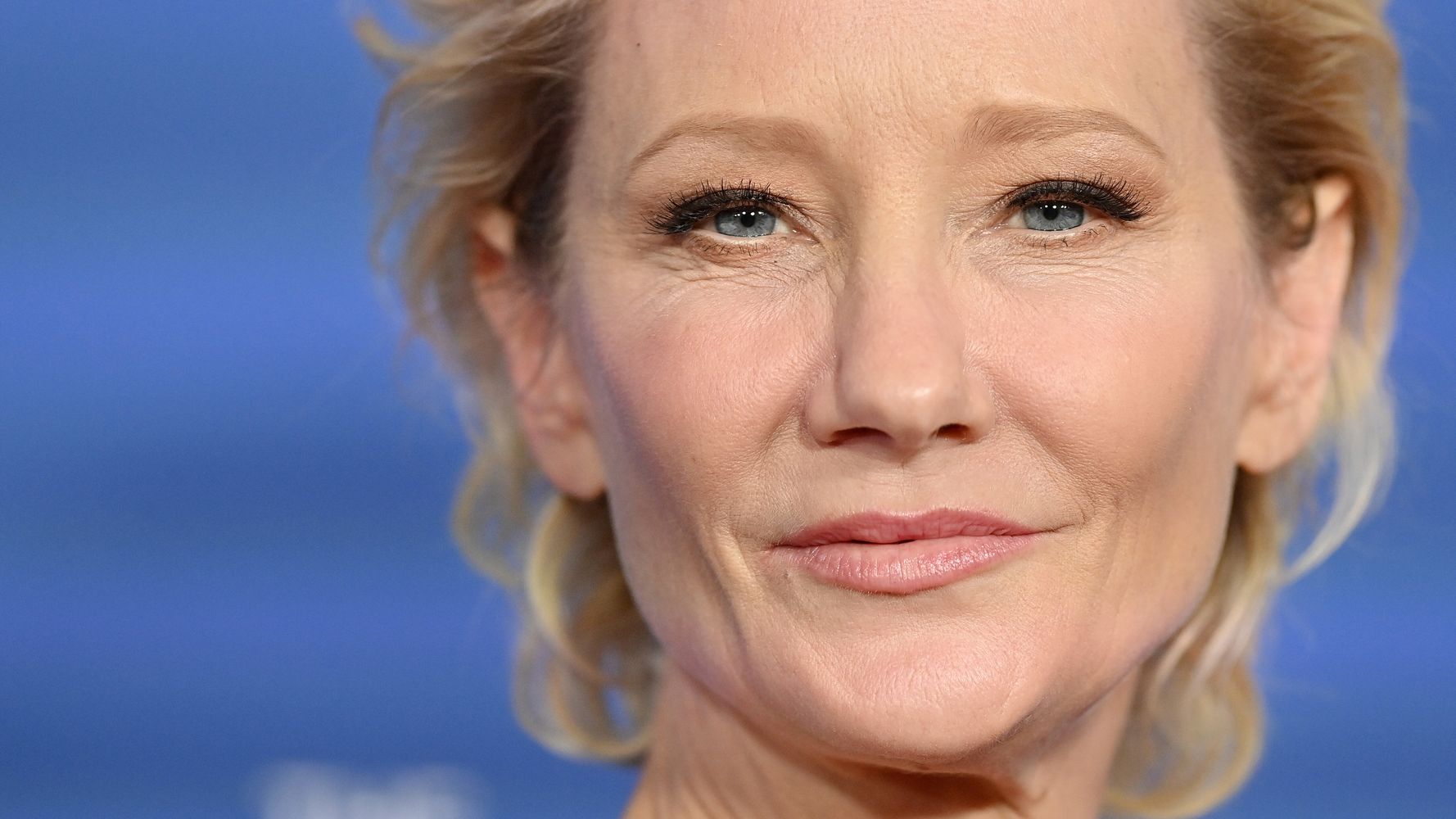 Actor Anne Heche seriously burned after car accident at Los Angeles home: report