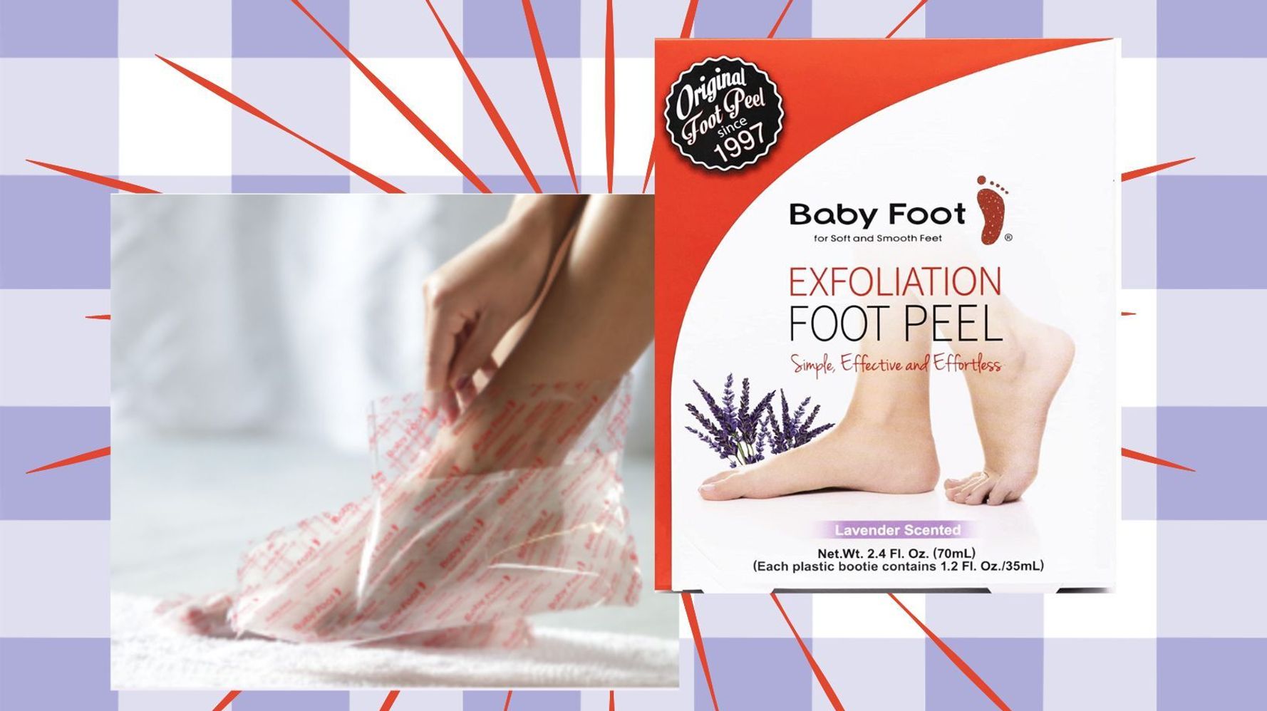 Get Amazingly Gross Results With This Internet-Famous Foot Peel