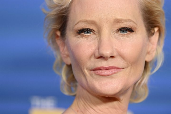 Actor Anne Heche suffered a devastating brain injury from a fiery car crash last week and is not expected to survive, a spokesperson for her family said.