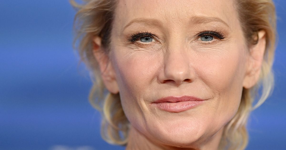 Anne Heche Not Expected To Survive Fiery Car Crash, Family Says