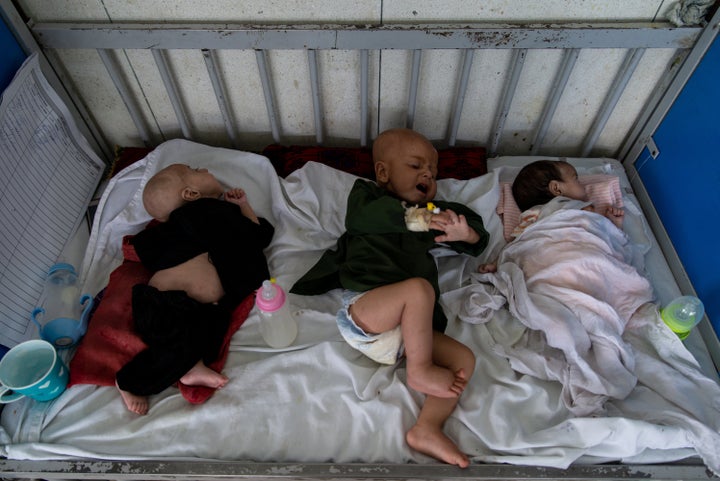 Babies being treated in Kabul for malnutrition