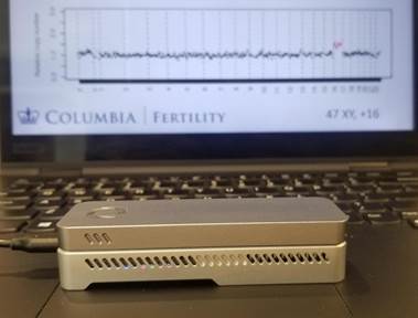 The STORK device, shown in front of an abnormal test result from a miscarriage.