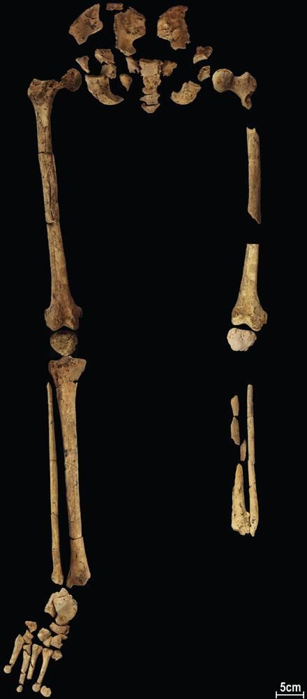 The prehistoric “surgery” could show that humans were making medical advances much earlier than previously thought, according to the study published on Sept. 7. 