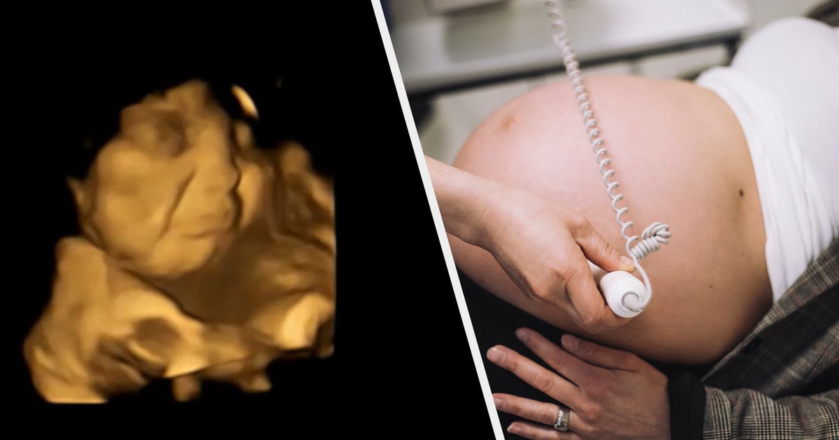 These Fascinating Scans Show Babies Reacting In The Womb To What Mum Eats