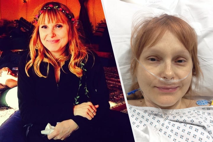 Maria at a festival before she her lupus diagnosis (left) and in hospital (right).
