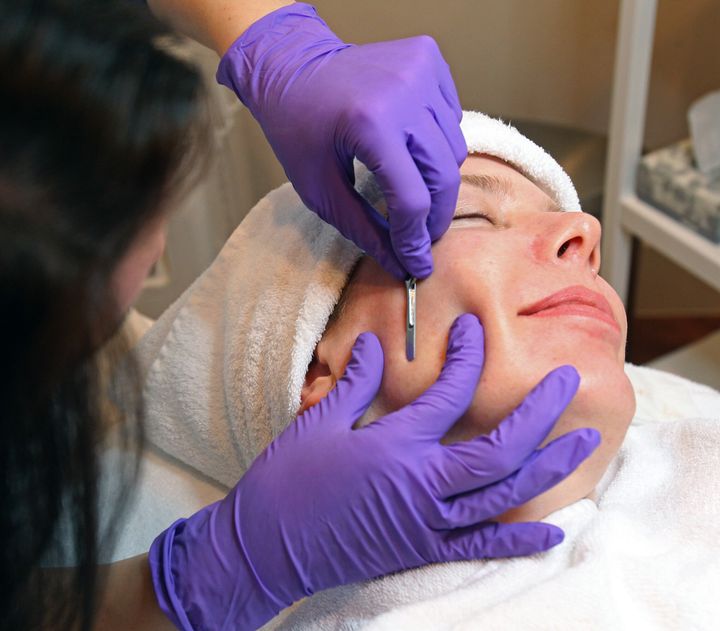 A patient undergoes dermaplaning during her facial at Julie Michaud Prettyology in Boston. But more and more people are opting to try it at home.