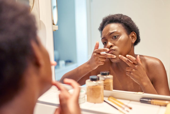 Putting toothpaste on your zit may be better than popping it, but aestheticians still don't recommend it.