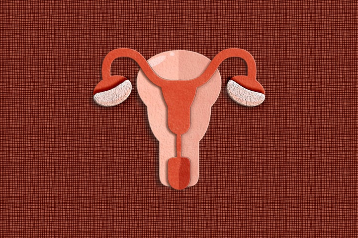 Roughly 5 million people have PCOS, a hormonal imbalance that can lead to many issues, including infertility.