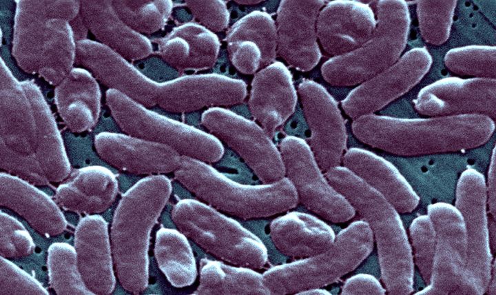 Vibrio vulnificus is naturally occurring and lives in warm, brackish water. It can lead to life-threatening infections when people with an unhealed wound or cut come in contact with bacteria-ridden floodwater.