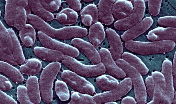 Vibrio vulnificus is naturally occurring and lives in warm, brackish water. It can lead to life-threatening infections when people with an unhealed wound or cut come in contact with bacteria-ridden floodwater.