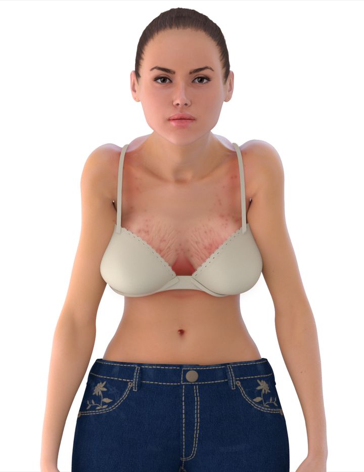Woman wearing the wrong bra size
