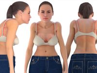 Bloom Bra - Wrong bra size can have serious effects on the