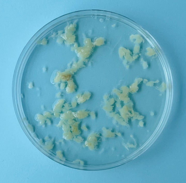 Decidua — uterine tissue — collected at four weeks of pregnancy.