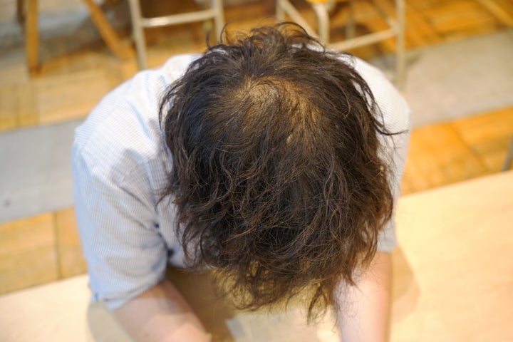 筆者近影。頭頂部が薄くなってきている。