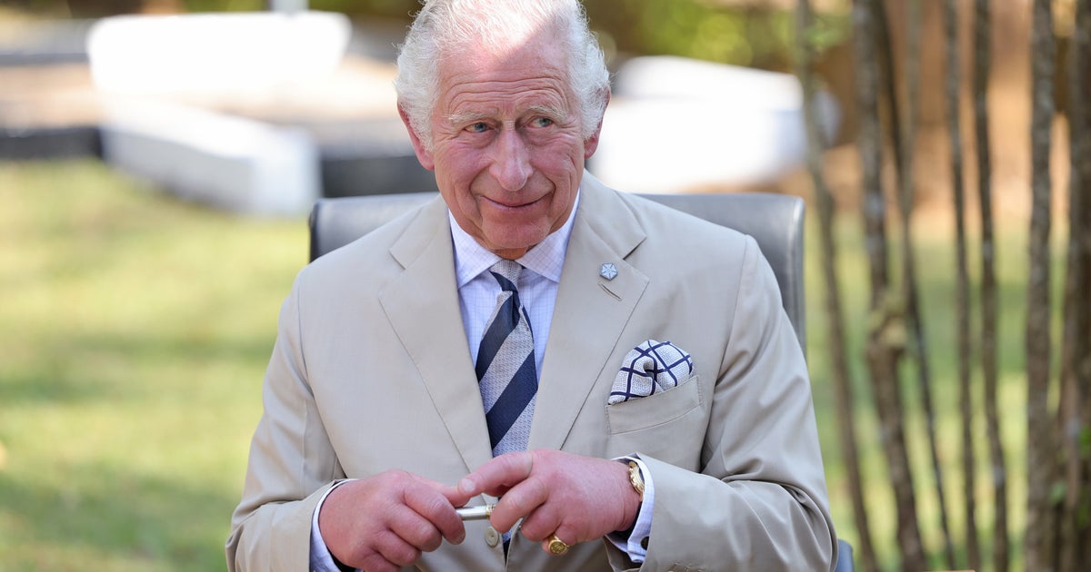 King Charles' Massive 'Sausage' Fingers Explained By Doctor HuffPost