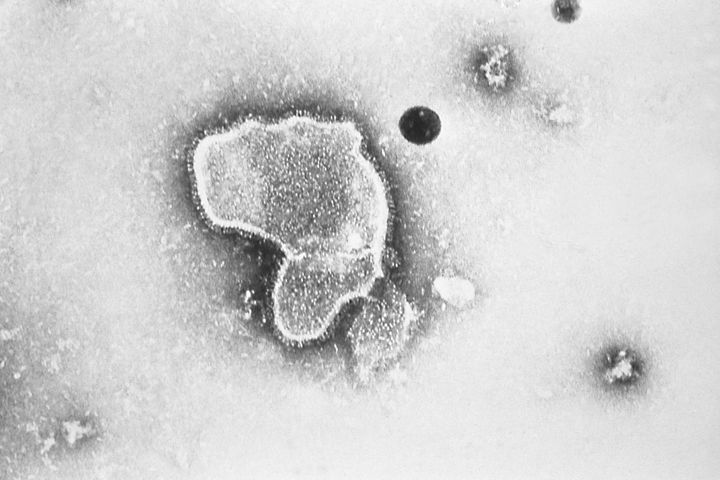 This 1981 photo provided by the Centers for Disease Control and Prevention (CDC) shows an electron micrograph of Respiratory Syncytial Virus, also known as RSV. New research announced by Pfizer on Nov. 1, 2022, showed vaccinating pregnant women helped protect their newborns from the common but scary respiratory virus that fills hospitals with wheezing babies each fall. 