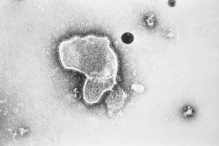This 1981 photo provided by the Centers for Disease Control and Prevention (CDC) shows an electron micrograph of Respiratory Syncytial Virus, also known as RSV. New research announced by Pfizer on Nov. 1, 2022, showed vaccinating pregnant women helped protect their newborns from the common but scary respiratory virus that fills hospitals with wheezing babies each fall.